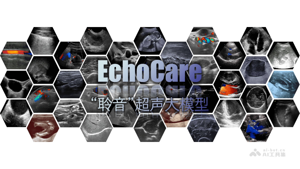 聆音EchoCare – 香港中科院推出的超声大模型